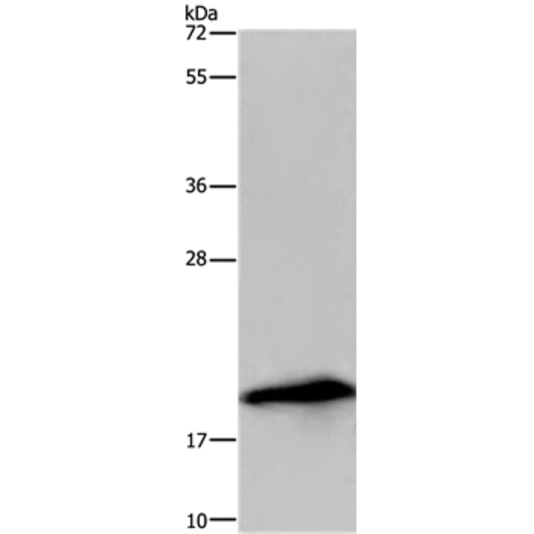 RNASE3 Antibody from Signalway Antibody (36432) - Antibodies.com
