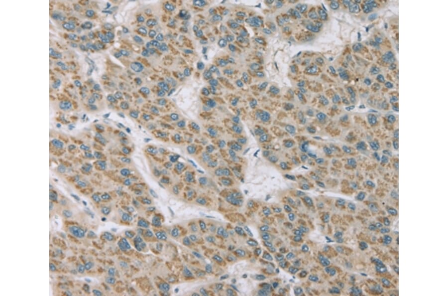 Immunohistochemistry - RNASE3 Antibody from Signalway Antibody (36432) - Antibodies.com
