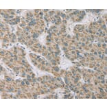 Immunohistochemistry - RNASE3 Antibody from Signalway Antibody (36432) - Antibodies.com