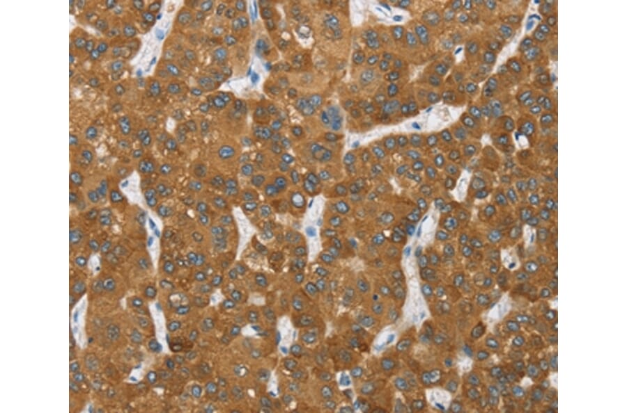 Immunohistochemistry - ENTPD5 Antibody from Signalway Antibody (36443) - Antibodies.com