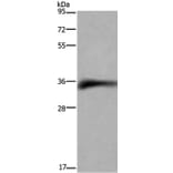 FCGR2B Antibody from Signalway Antibody (36473) - Antibodies.com
