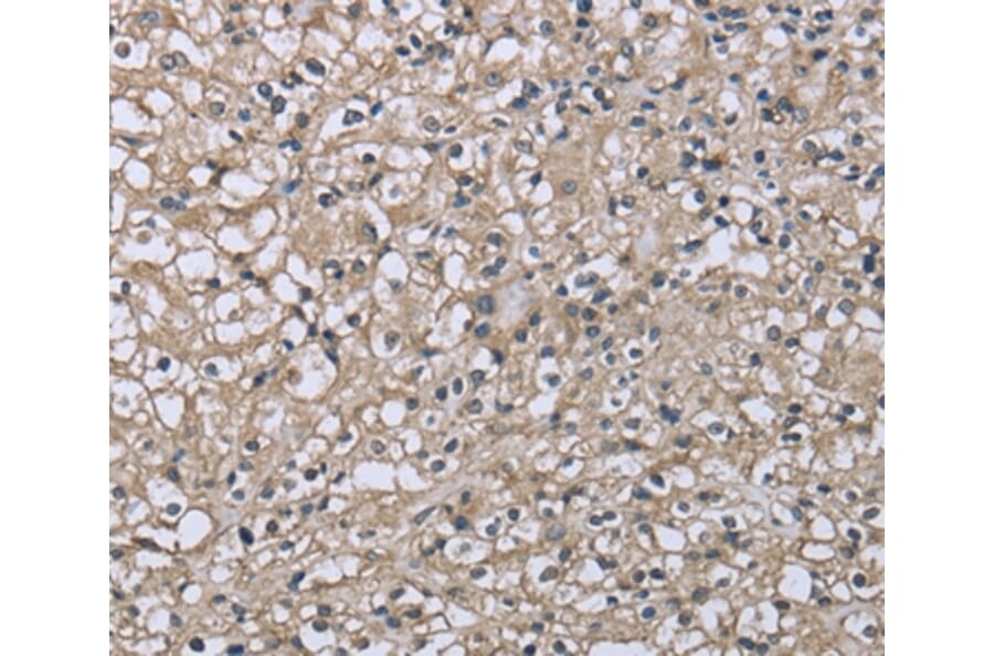 Immunohistochemistry - FCGR2B Antibody from Signalway Antibody (36473) - Antibodies.com