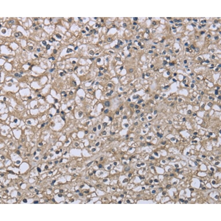 Immunohistochemistry - FCGR2B Antibody from Signalway Antibody (36473) - Antibodies.com