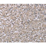 Immunohistochemistry - FCGR2B Antibody from Signalway Antibody (36473) - Antibodies.com