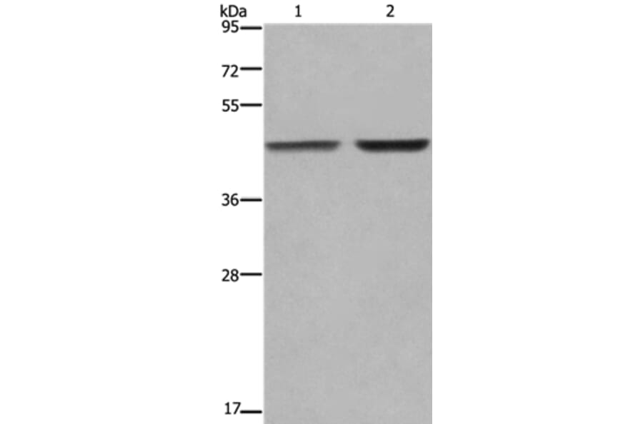 GABPB2 Antibody from Signalway Antibody (36491) - Antibodies.com