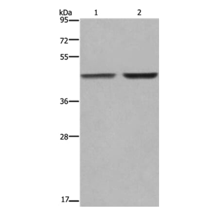 GABPB2 Antibody from Signalway Antibody (36491) - Antibodies.com