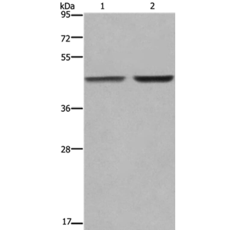 GABPB2 Antibody from Signalway Antibody (36491) - Antibodies.com
