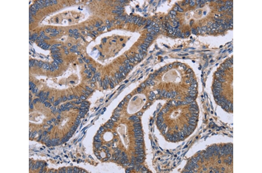 Immunohistochemistry - GABPB2 Antibody from Signalway Antibody (36491) - Antibodies.com