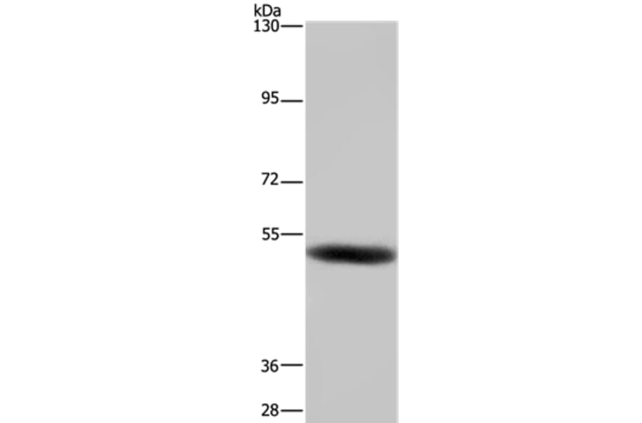 GABRB1 Antibody from Signalway Antibody (36496) - Antibodies.com