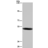 GABRB1 Antibody from Signalway Antibody (36496) - Antibodies.com