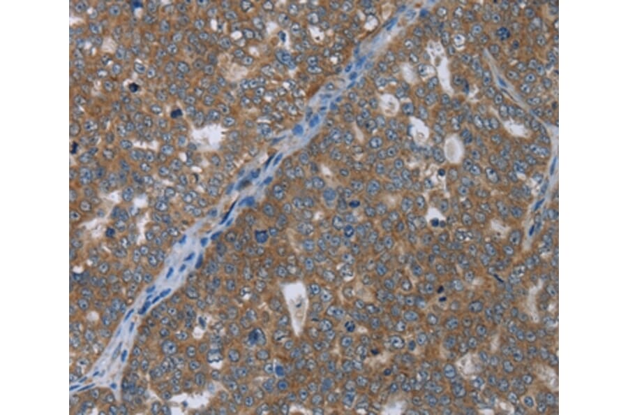 Immunohistochemistry - GABRB1 Antibody from Signalway Antibody (36496) - Antibodies.com