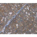 Immunohistochemistry - GABRB1 Antibody from Signalway Antibody (36496) - Antibodies.com