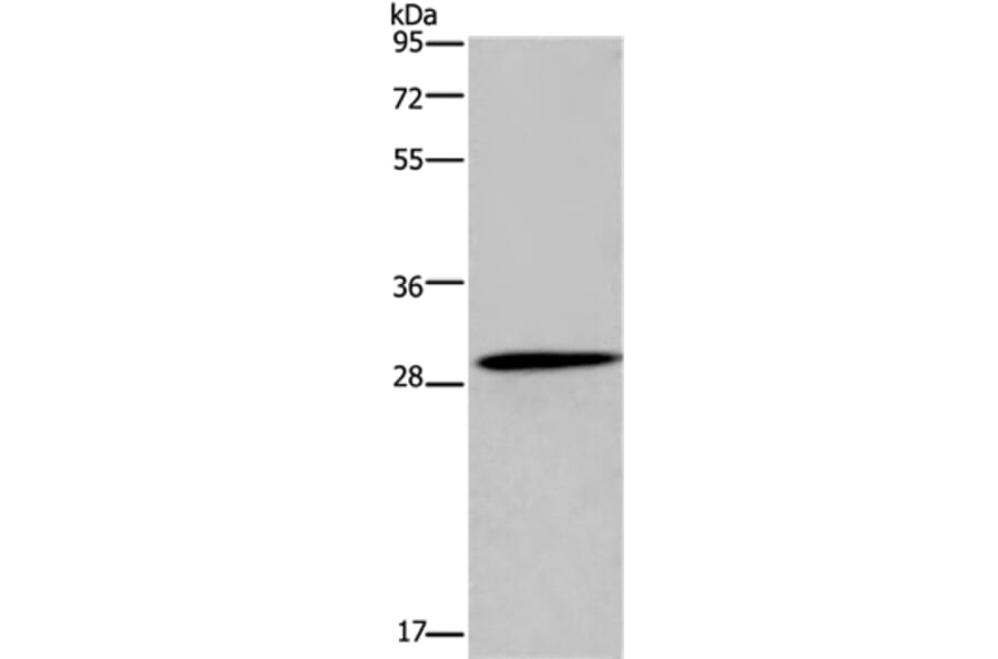 GLIPR1 Antibody from Signalway Antibody (36505) - Antibodies.com