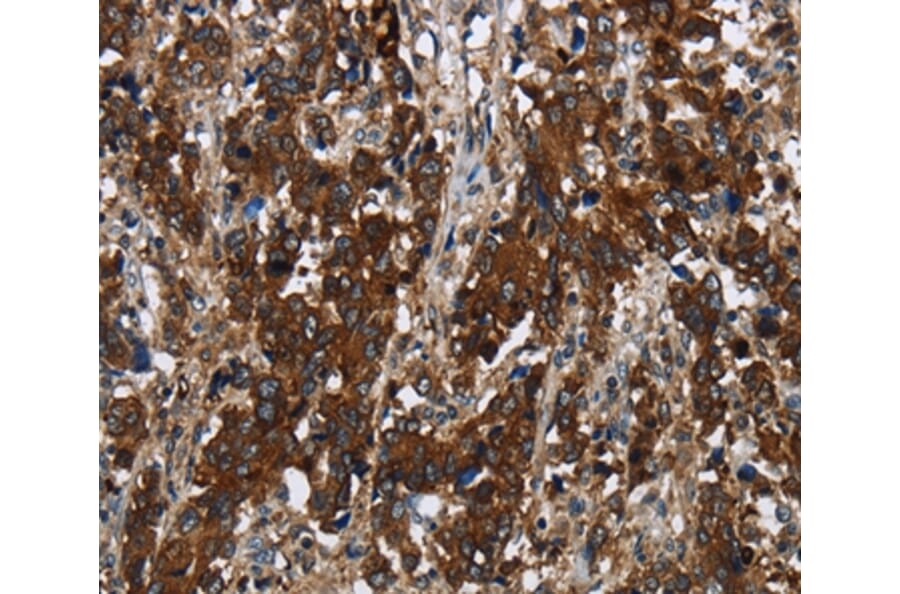 Immunohistochemistry - GLIPR1 Antibody from Signalway Antibody (36505) - Antibodies.com
