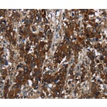 Immunohistochemistry - GLIPR1 Antibody from Signalway Antibody (36505) - Antibodies.com