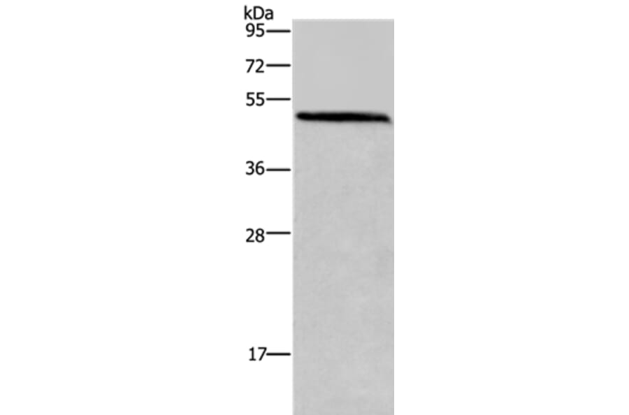 HOMER1 Antibody from Signalway Antibody (36523) - Antibodies.com