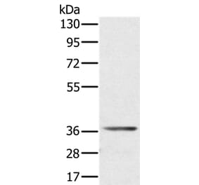 AKR1C4 Antibody from Signalway Antibody (36535) - Antibodies.com