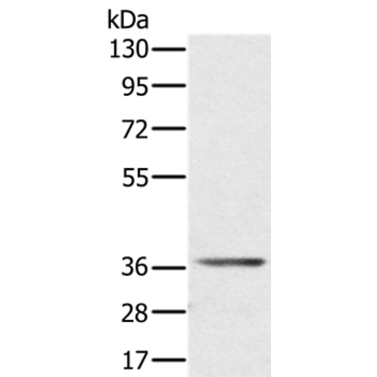 AKR1C4 Antibody from Signalway Antibody (36535) - Antibodies.com