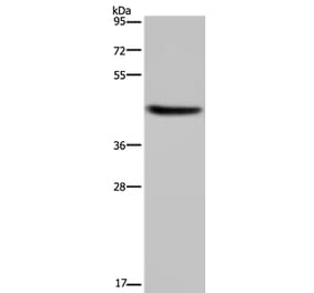 HSD3B1 Antibody from Signalway Antibody (36536) - Antibodies.com