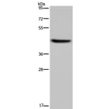 HSD3B1 Antibody from Signalway Antibody (36536) - Antibodies.com