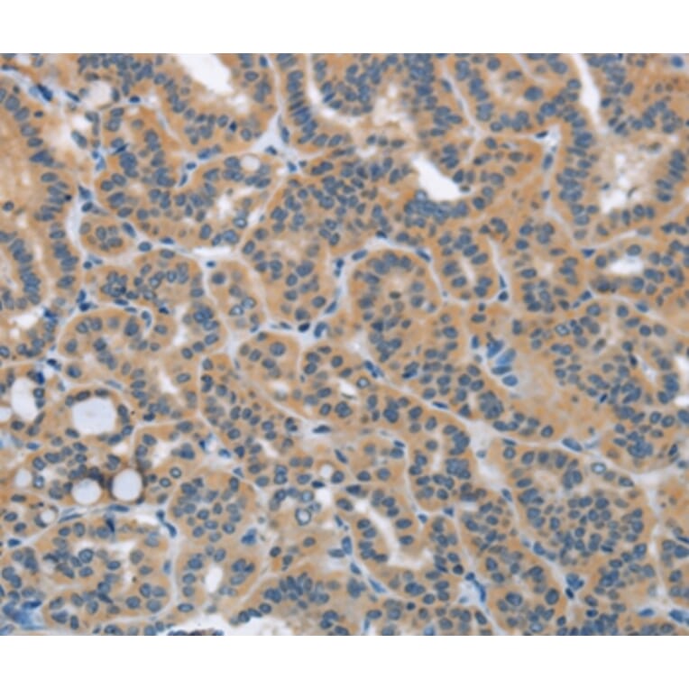 Immunohistochemistry - HSD3B1 Antibody from Signalway Antibody (36536) - Antibodies.com