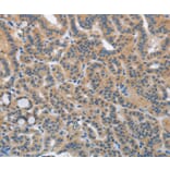 Immunohistochemistry - HSD3B1 Antibody from Signalway Antibody (36536) - Antibodies.com