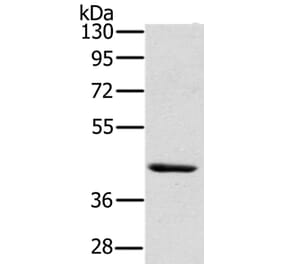 HSD3B7 Antibody from Signalway Antibody (36537) - Antibodies.com