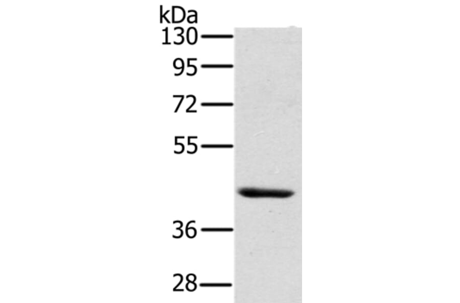 HSD3B7 Antibody from Signalway Antibody (36537) - Antibodies.com
