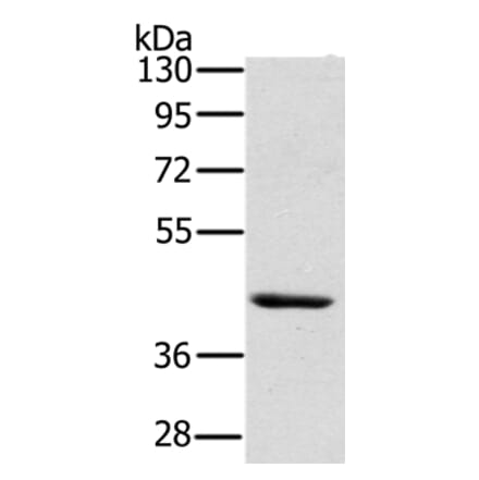 HSD3B7 Antibody from Signalway Antibody (36537) - Antibodies.com