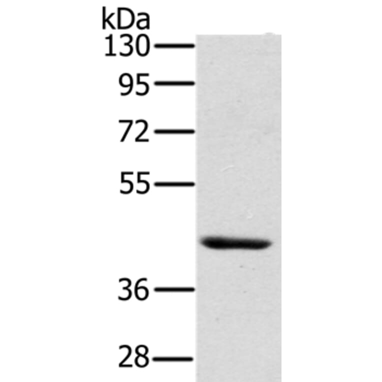HSD3B7 Antibody from Signalway Antibody (36537) - Antibodies.com