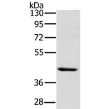 HSD3B7 Antibody from Signalway Antibody (36537) - Antibodies.com