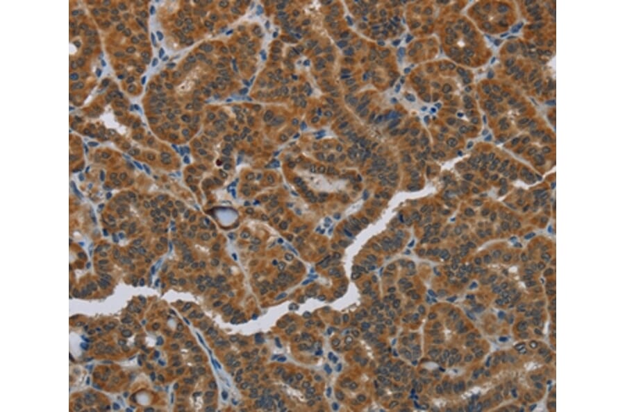 Immunohistochemistry - HSD3B7 Antibody from Signalway Antibody (36537) - Antibodies.com