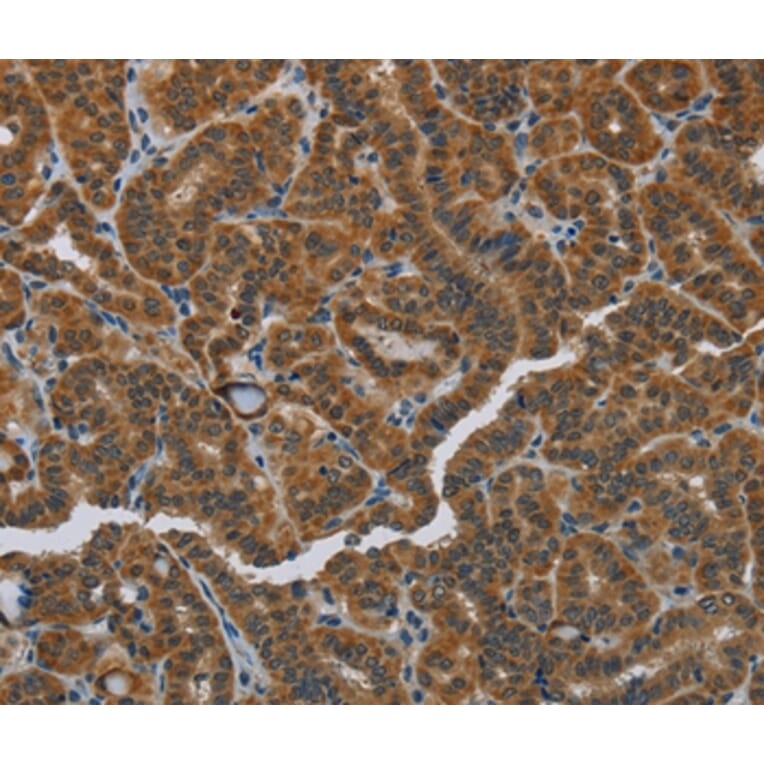 Immunohistochemistry - HSD3B7 Antibody from Signalway Antibody (36537) - Antibodies.com
