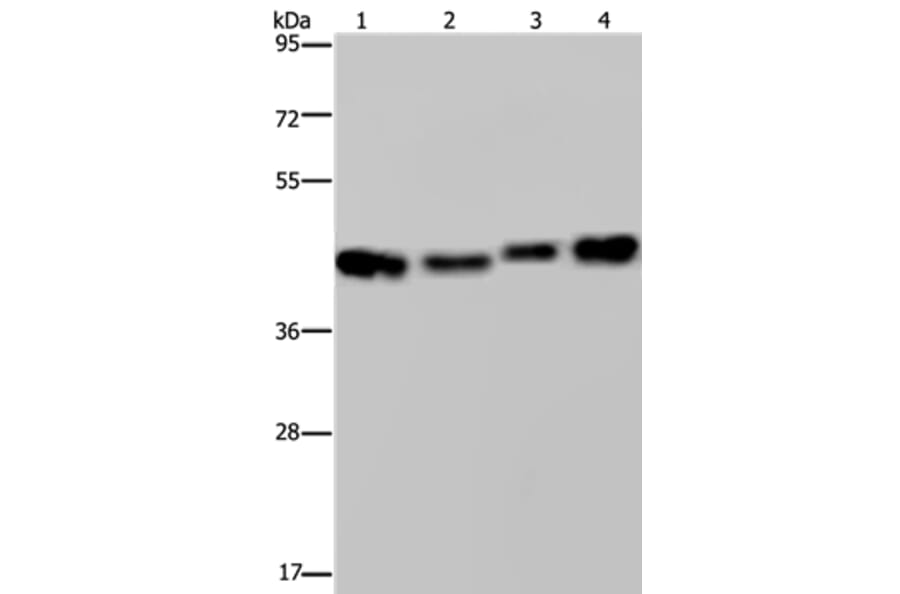 DNAJA1 Antibody from Signalway Antibody (36538) - Antibodies.com