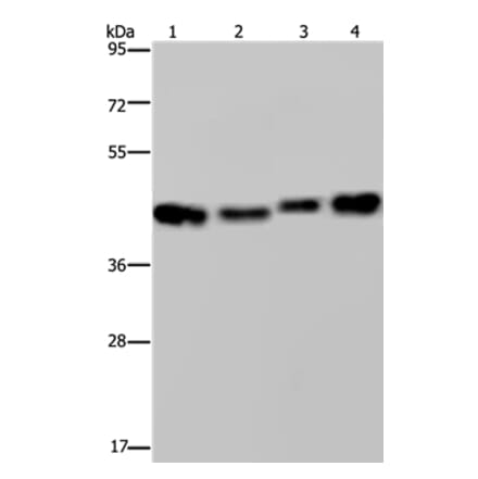 DNAJA1 Antibody from Signalway Antibody (36538) - Antibodies.com