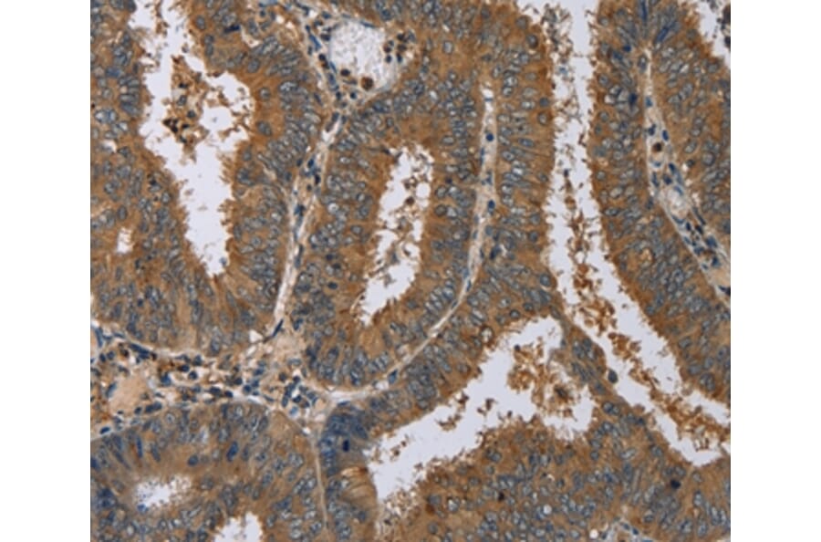 Immunohistochemistry - DNAJA1 Antibody from Signalway Antibody (36538) - Antibodies.com
