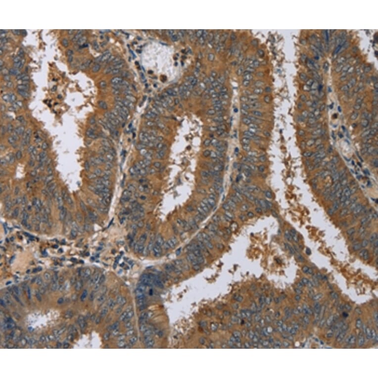 Immunohistochemistry - DNAJA1 Antibody from Signalway Antibody (36538) - Antibodies.com