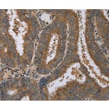 Immunohistochemistry - DNAJA1 Antibody from Signalway Antibody (36538) - Antibodies.com
