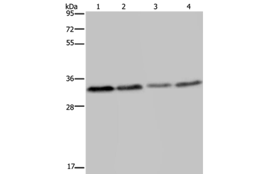 TICAM2 Antibody from Signalway Antibody (36542) - Antibodies.com