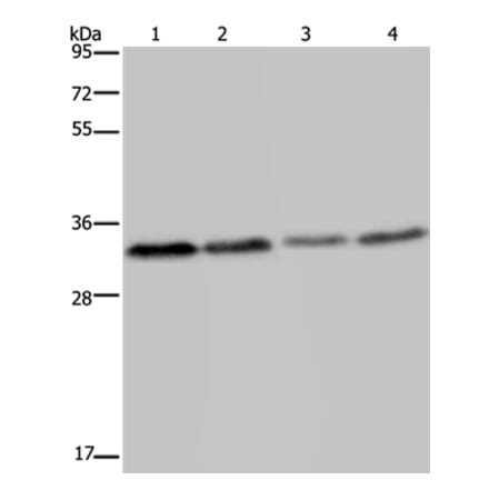TICAM2 Antibody from Signalway Antibody (36542) - Antibodies.com