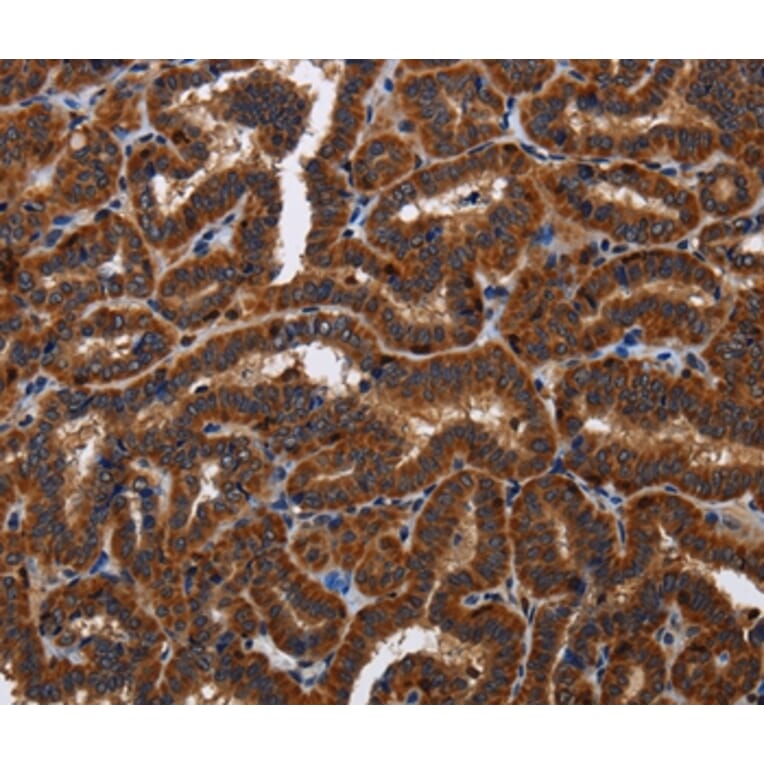 Immunohistochemistry - TICAM2 Antibody from Signalway Antibody (36542) - Antibodies.com