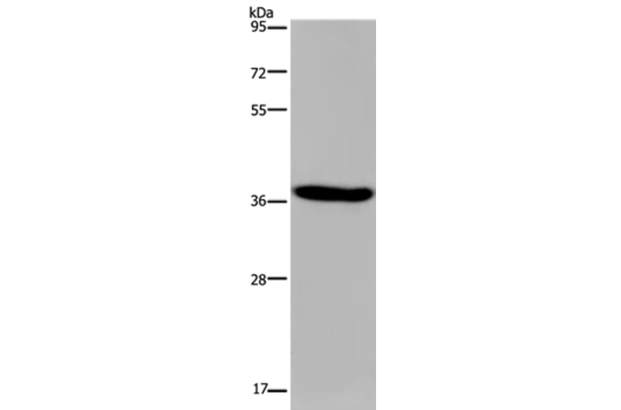 KCNK17 Antibody from Signalway Antibody (36566) - Antibodies.com
