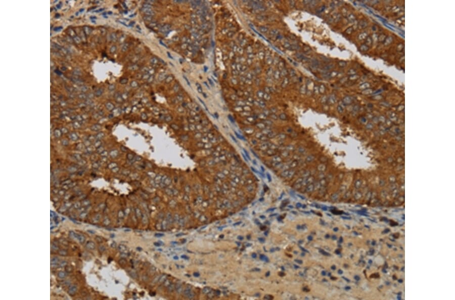 Immunohistochemistry - KCNK17 Antibody from Signalway Antibody (36566) - Antibodies.com