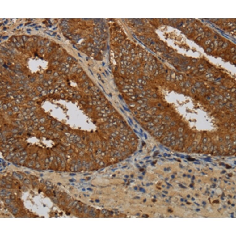 Immunohistochemistry - KCNK17 Antibody from Signalway Antibody (36566) - Antibodies.com