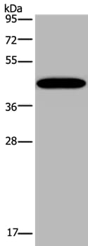 Gel: 10% SDS-PAGE Lysates (from left to right): Mouse lung tissue Amount of lysate: 40ug per lane Primary antibody: 1/200 dilution Secondary antibody dilution: 1/8000 Exposure time: 10 minutes