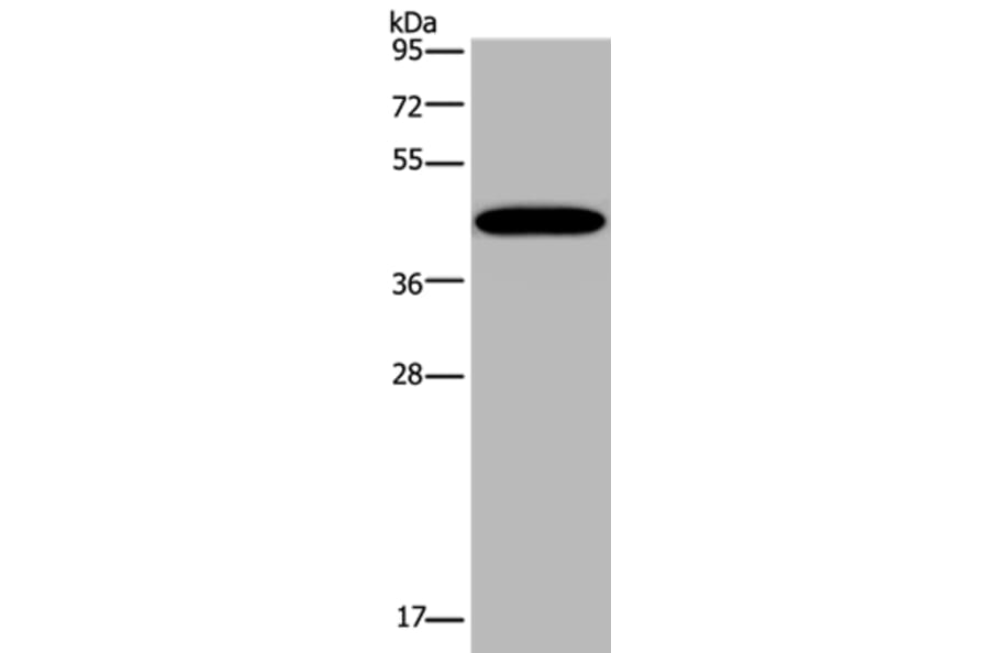 KCNK13 Antibody from Signalway Antibody (36567) - Antibodies.com