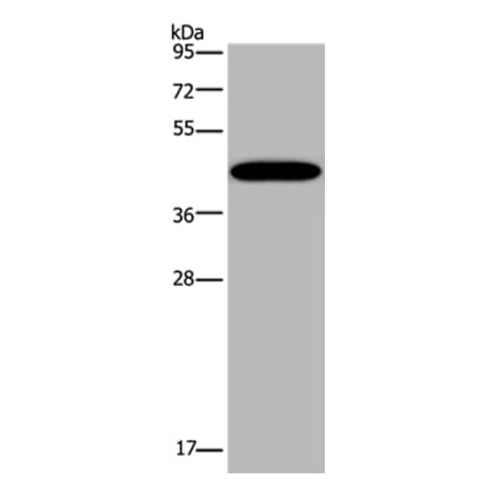 KCNK13 Antibody from Signalway Antibody (36567) - Antibodies.com