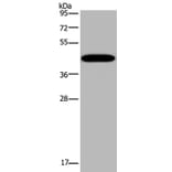 KCNK13 Antibody from Signalway Antibody (36567) - Antibodies.com