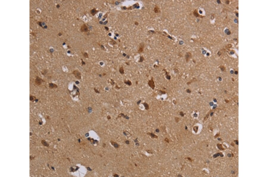Immunohistochemistry - KCNK13 Antibody from Signalway Antibody (36567) - Antibodies.com