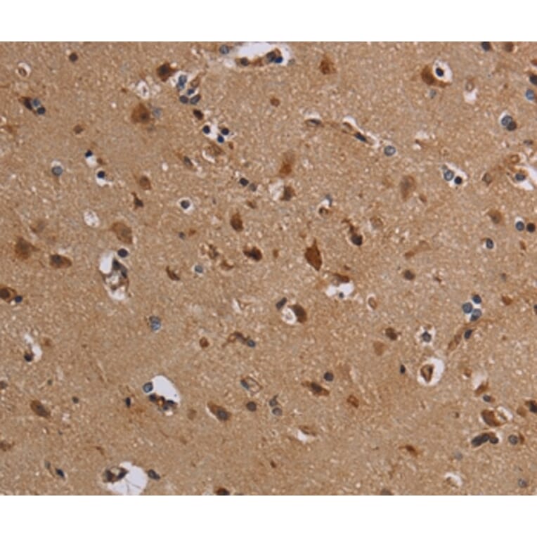 Immunohistochemistry - KCNK13 Antibody from Signalway Antibody (36567) - Antibodies.com